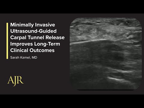 Minimally Invasive Ultrasound-Guided Carpal Tunnel Release Improves Long-Term Clinical Outcomes