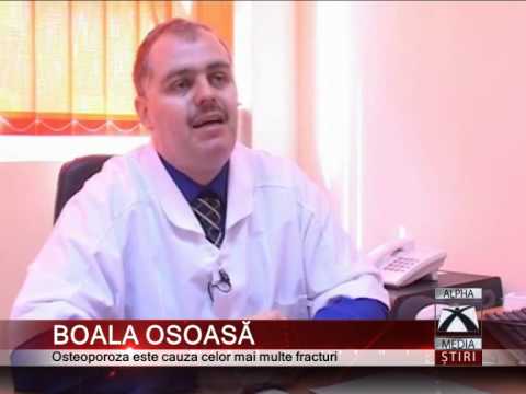 Artrita reumatoidă în articulația șoldului