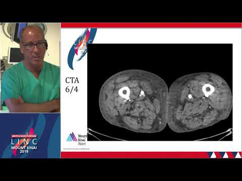 Venovo Clinical Trial Results - Dr. Lookstein