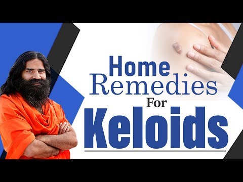 Home Remedies For Keloids | Swami Ramdev