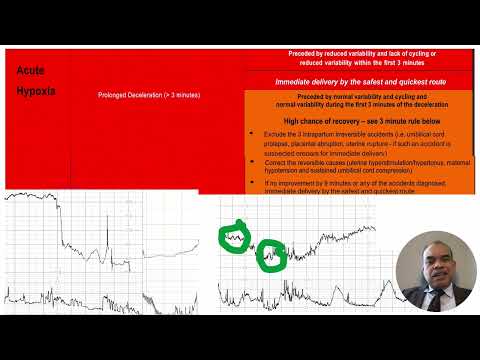 Implementation of  EssentialTools for Physiological Interpretation of Cardiotocograph (CTG)