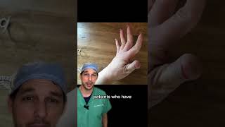 Download lagu Got swan necks? #Swan #Deformity #Hypermobility #Hand #MedicalStudent #Laxity #EhlersDanlos #Dr mp3