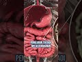 Apa Itu Askariasis Penyebab Tubuh Raya Penuh Cacing