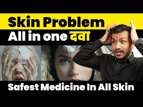 321:Sabhi Tarah Ke Skin Disorders Me Sabse Sasti Aur Asardar Dawa|| Safest Medicine In All Skin Video
