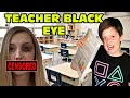 Kid Gives His Teacher A Black Eye After Throwing Book At Her SUSPENDED