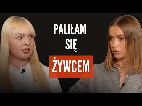 Maja Kuczyńska: paliła się żywcem, dostała nowe życie.