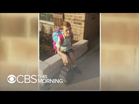 Dentist's 30-second procedure helps tongue-tied boy speak