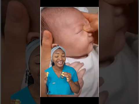 Doctor explains crigler massage to help crusted eyes in babies #blockedtearduct #newborns