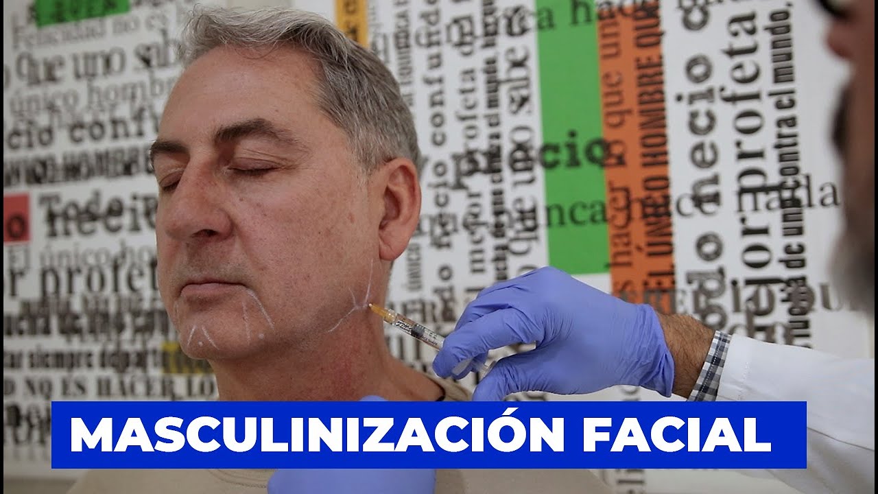 Masculinización Facial | Doctor Leo Cerrud