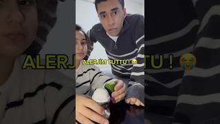 Download lagu ALERJİM TUTTU ! mp3 Download lagu ALERJİM TUTTU ! mp3