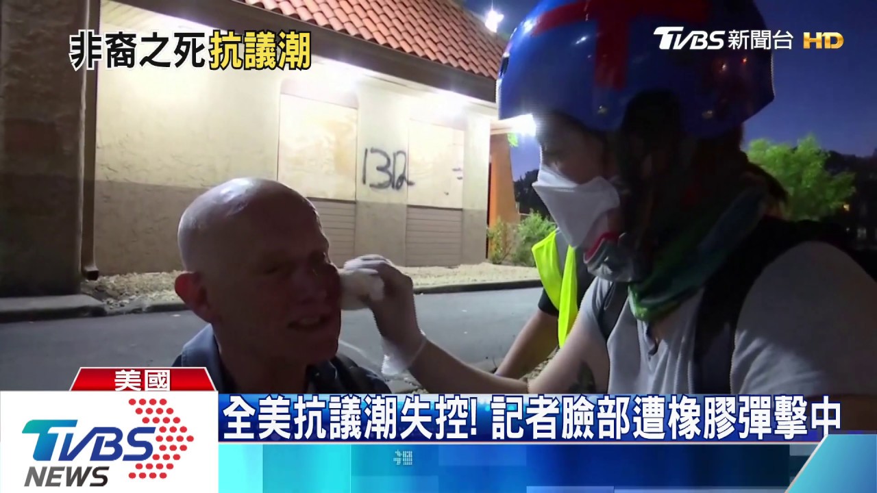 街道變戰場！全美抗議失控　橡膠彈擊中記者臉部