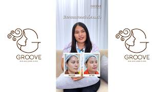 ฝ้ากระกวนใจ 5 ปี