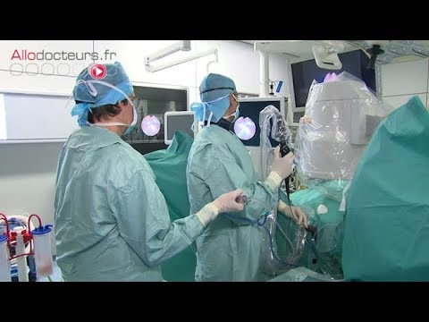 L'urétéroscopie, une opération simple pour un rein sans calculs - Allô Docteurs