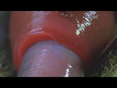 Monster red leech vs earthworm