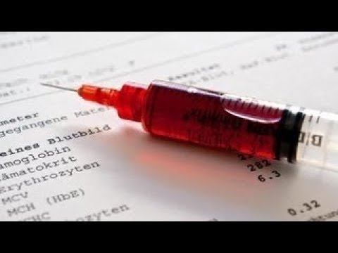 Die unsichtbaren Feinde der Menschen - Viren Doku ᴴᴰ 2017