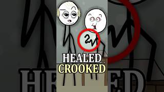 Broken Bones Could Leave You Deformed 🦴😮 #history #facts #medieval #shorts