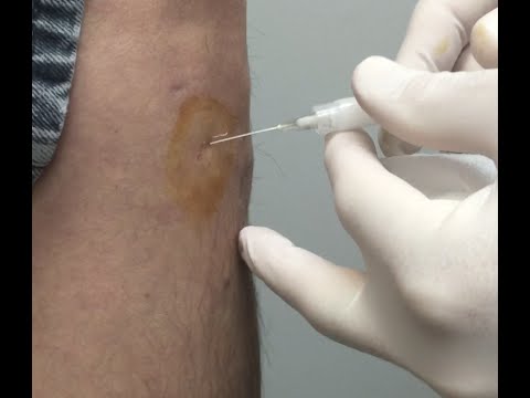 Die Knie Ultraschall Novosibirsk Preise Wenn schlecht wund Knochen und zurück, was zu tun
