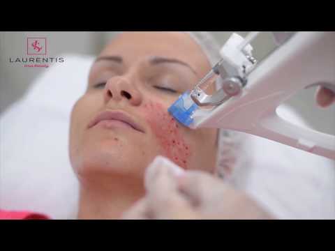 Elite Clinic Topoľčany - všetko pre Vašu krásnu a zdravú pokožku a nerušený relax