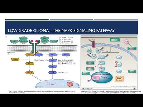 Video 231 1 Genetics of Pediatric Brain Tumors
