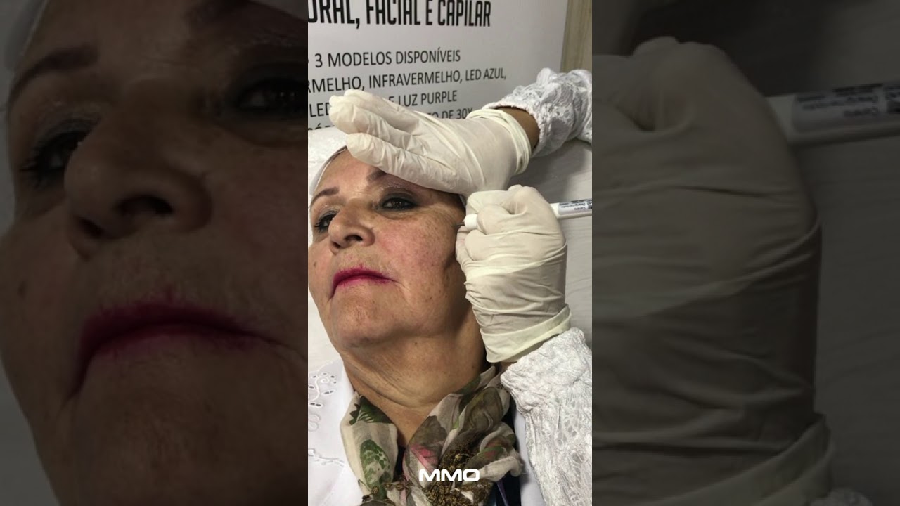 Protocolo de Rejuvenescimento New Skin + Vênus - Prof Cecília Manoel