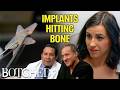 Ribcage Implants Ashlea S Extreme Body Mods Put Her Health At Risk Before After Botched E