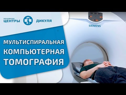 Остеохондроз шейный и вегетативная сосудистая дистония Дикий каштан суставы