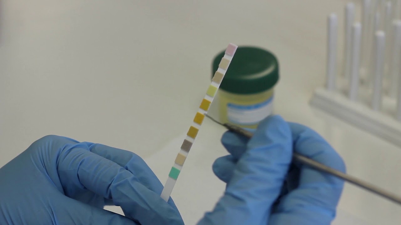 Análisis Bioquímico de la Orina