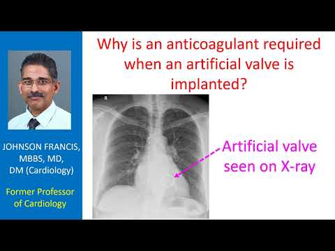 Why is an anticoagulant required when an artificial valve is implanted?