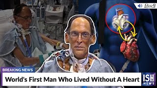 World’s First Man Who Lived Without A Heart
