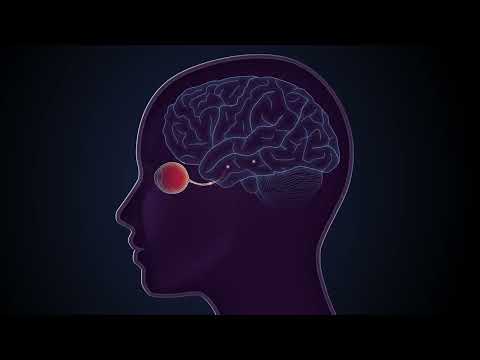 An Artificial Retina aiming to restore sight for people with damaged retinas