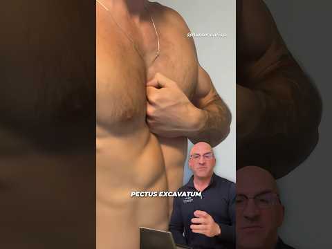 Funnel Chest - Don’t Blame the Goats 🐐 #shorts