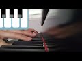 Ida de pinza improvisada en medio de lesi&oacute;n de manos!