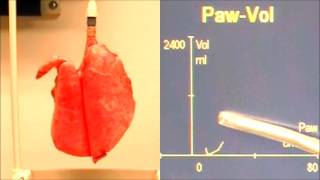 Spirometry loops