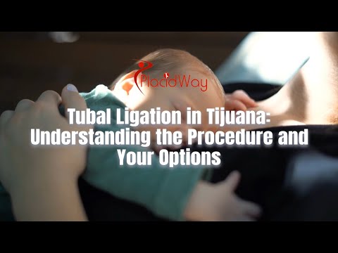 Tubal Ligation in Tijuana, Mexico: Exploring the Procedure and Your Choices