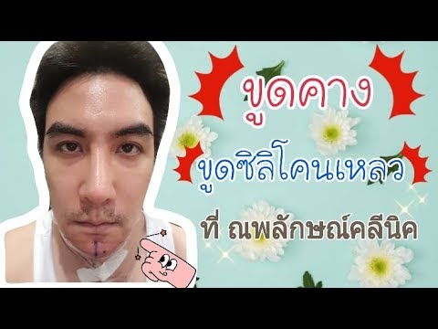คลิกเพื่อดูคลิปวิดีโอ