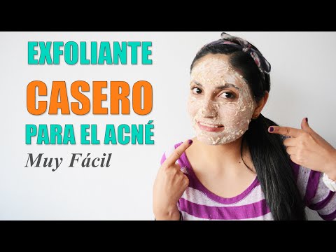 Exfoliante casero para el acné