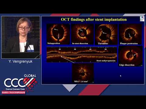 Intravascular Imaging to Optimize PCI Outcomes - Yuliya Vengrenyuk
