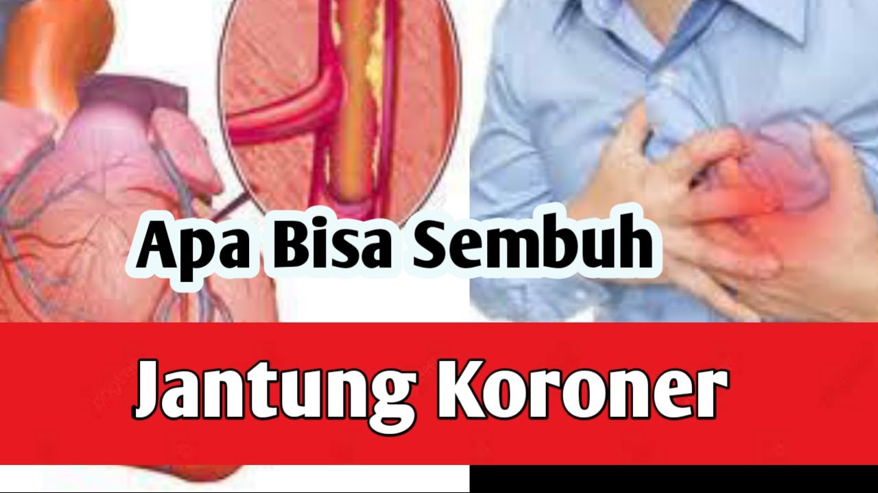 Apakah Penyakit Jantung Koroner Bisa Sembuh? Apakah Penyakit Jantung Koroner Bisa Sembuh?