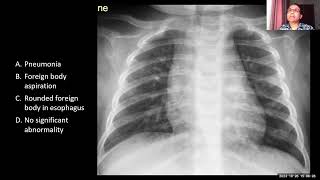 Pediatric Radiology - Ajay D'souza