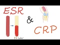 ESR Und CRP