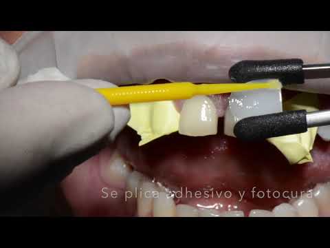 CCC-COMPONEER BRILLIANT Dr. Edgar García