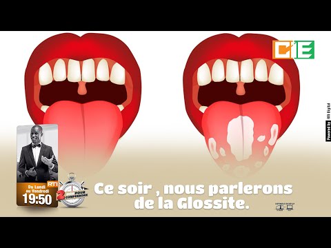 2 mn pour comprendre, la Glossite