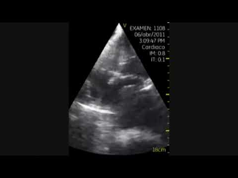USMLE Practice Questions and Answers #43 I Neurology & Anatomy