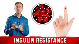 Understanding Insulin Resistance and What You Can Do About It