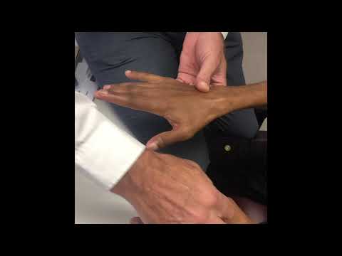 High median nerve palsy