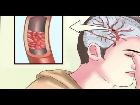 download lagu mp3 mp4 Magnesona Zero Preo, download lagu Magnesona Zero Preo gratis, unduh video klip Magnesona Zero Preo