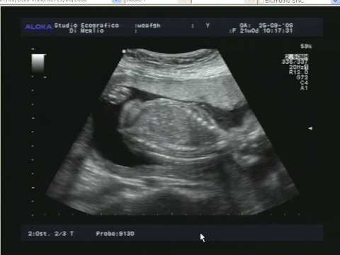 Dolori alle articolazioni delle mani dopo un allenamento Mese dopo il parto il dolore addominale e la parte bassa della schiena