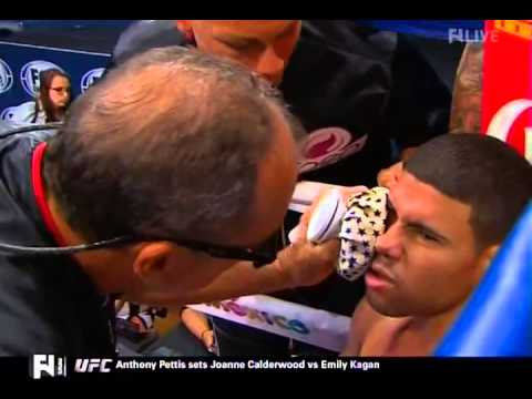 Juan Manuel Lopez vs Jesus Cuellar 11 09 2014