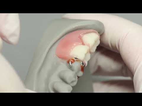 BEGO WIRONIUM® RP Complete – Tutorial for the Bonding Process