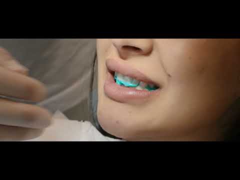 Müller-Omicron - granit PERFEKT D45